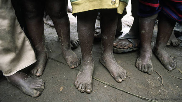 Mensagem para o Dia Mundial dos Pobres será apresentada nesta quinta Mensagem para o Dia Mundial dos Pobres será apresentada nesta quinta